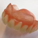 New Valplast Full Dentures