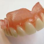 Flexible Full Dentures 